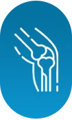 fig-osteoarthritis