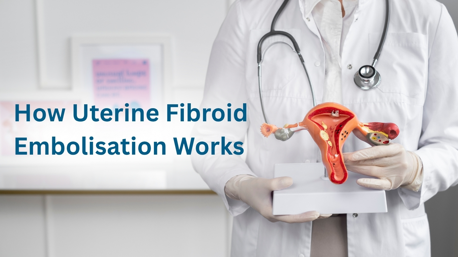How Uterine Fibroid Embolisation Works: Procedure, Recovery & Results