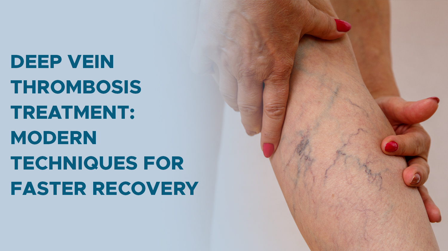 Deep Vein Thrombosis Treatment: Modern Techniques for Faster Recovery