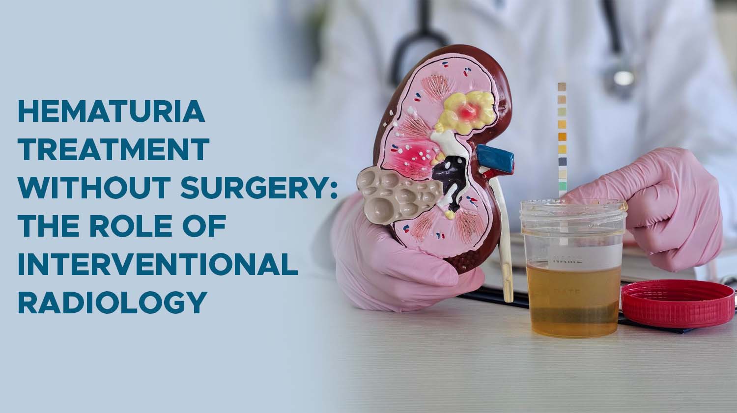 Hematuria Treatment Without Surgery: The Role of Interventional Radiology